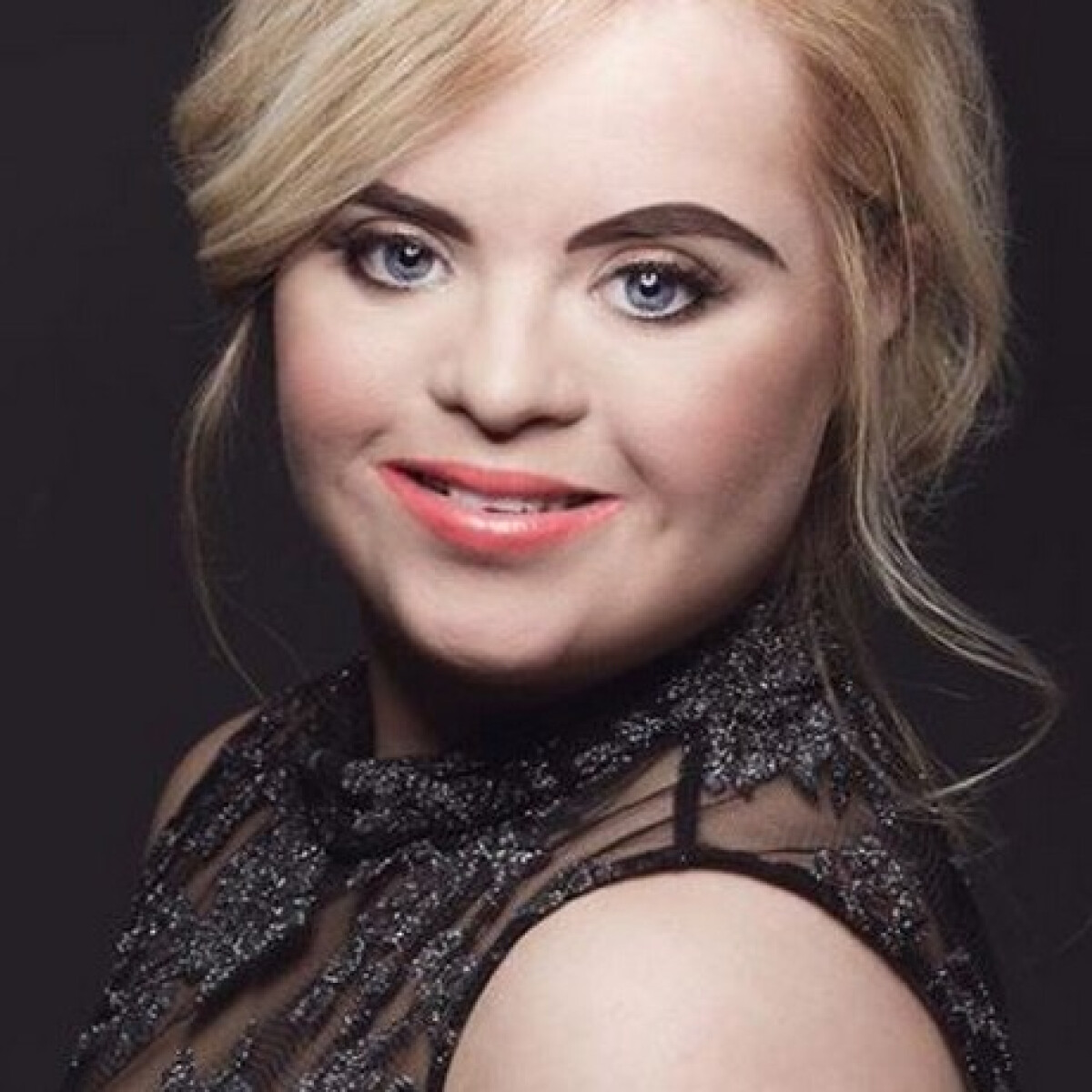 Kate, a szép Down-szindrómás modell a divatvilág egyik legkülönlegesebb személyisége