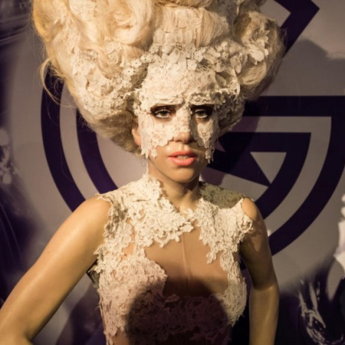 Fybromialgia - Lady Gaga titokzatos betegsége